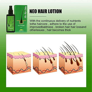 لوشن مصل نمو الشعر علاج تساقط الشعر Hair Growth Serum Hair Lotion,Hair Loss Treatments, Aids against Hair-thining, Hair Regrowth Treatment(120ml)