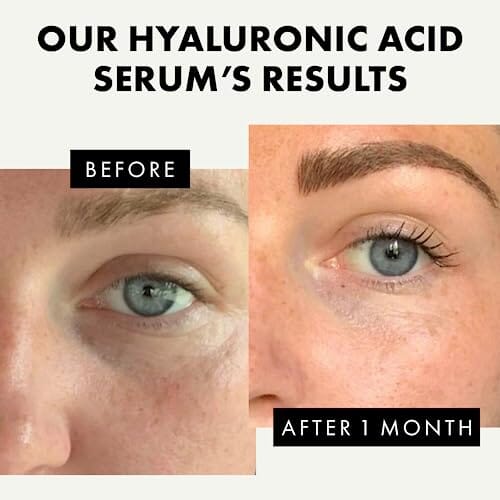 مصل مضاد للشيخوخة للوجه  Pure Hyaluronic Acid Face Serum - 2.5% Hyaluronic Serum + 3% B5, Anti Wrinkle + Anti Aging Serum for Face with Vitamin C & E, Aloe - Antiaging Hydrating Serum Hylunaric Acid Serum