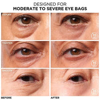 معالجة نهارية IT Cosmetics Bye Bye Under Eye Bags Daytime Treatment – Depuffs, Tightens, Smooths & Reduces Look of Wrinkles & Fine Lines – All Skin Tones – Comfortable on Bare Skin or Over Makeup - 0.5 Fl. Oz