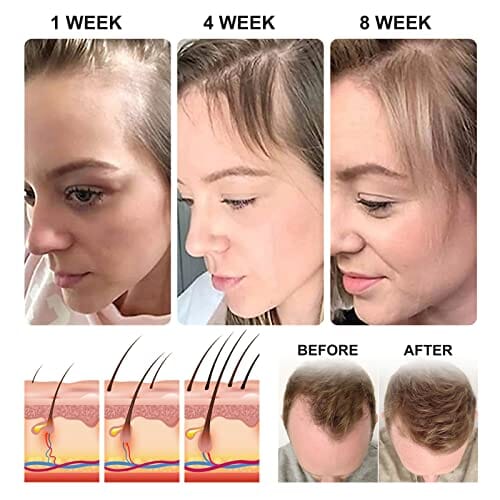 زيت الشعر للشعر الجاف التالف Pack Rice Water for Hair Growth, Hair oil for Dry Damaged Hair and Growth, Hair Growth Serum for Stronger, Thicker, Longer Hair, Natural Hair Moisturizer & Conditioner with Vitamin & Mineral - 2.02 fl.oz