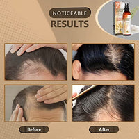 ماء الأرز لنمو الشعر Rice Water for Hair Growth, Organic Fermented Hair Growth Spray Hair Growth Treatment Leave-In Mist with Rosemary Biotin Caffeine Keratin for Hair Loss Men and Women