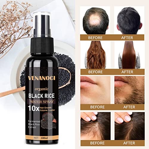 ماء الأرز لنمو الشعر  Venanoci Hair Growth Serum, Rice Water for Hair Growth for Women & Men, Hair Loss Treatment, Rice Water Spray for Damaged Dry Hair Treatment, Hair Regrowth Treatment for Thicker Longer Fuller Hair with Castor oil Ginger