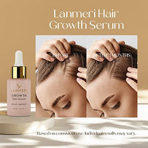 مصل نمو الشعر النباتي Lanmeri Vegan Hair Growth Serum - Natural Hair Regrowth and Hair Loss Treatments for Women & Men - Scalp Serum for Thinning Hair and Hair Loss - Fuller-looking, Thicker and Healthier Hair in 90 Days, All Hair Types