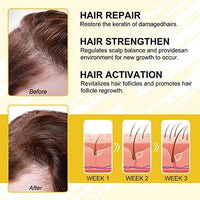 ماء الأرز لنمو الشعر Hair Growth Serum, Rice Water for Hair Growth, Hair Growth oil for Men and Women, Biotin Hair Growth oil, Hair Loss Treatments for Women, Hair Regrowth Treatment for Stronger Thicker Longer Hair