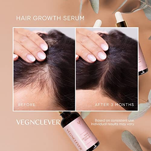 زيت نباتي طبيعي لنمو الشعر Vegnclever Hair Growth Serum for Women, Veganic Natural Hair Growth Oil - 100% Vegan Hair Regrowth Serum, Gro Hair Serum for Hair Loss, Hair Thickening Products for Women, 50ML