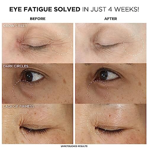 كريم العين المضاد للشيخوخة للهالات السوداء وتجاعيد Confidence in an Eye Cream, Anti Aging Eye Cream for Dark Circles, Crow's Feet, Lack of Firmness & Dryness, 48HR Hydration with 2% Super Peptide Concentrate, for Day + Night - 0.5 fl oz