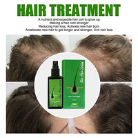 لوشن مصل نمو الشعر علاج تساقط الشعر Hair Growth Serum Hair Lotion,Hair Loss Treatments, Aids against Hair-thining, Hair Regrowth Treatment(120ml)