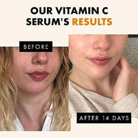 مصل فيتامين سي للوجه Vitamin C Face Serum - Hyaluronic Acid, Retinol, & Vit E - Anti Aging Facial Brightening Serum for Skin Care - Timeless Pure Vitamin C Serum for Face Dark Spots, Vit C Serum Oil, Face Serum for Women