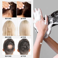 شامبو رايس ووتر لنمو الشعر  Rice Water for Hair Growth Shampoo for Thinning Hair and Hair Loss for Women, Rosemary Oil & Biotin Shampoo for Hair Growth, Anti Hair Loss & Thinning Shampoo for Hair Regrowth for Men, All Hair Types