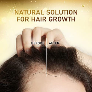 سيروم بيوتين لنمو الشعر بزيت الخروع وزيت الأرغان Biotin Hair Growth Serum with Castor Oil, Argan Oil - Hair Loss Prevention Treatment with Hair Regrowth Formula for Women by Beaueli