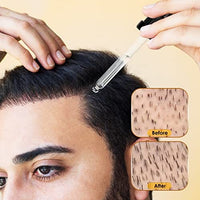 مصل نمو الشعر مينوكسيديل  Minoxidil 5% Hair Growth Serum Oil Biotin Hair Regrowth Treatment for Scalp Hair Loss Hair Thinning for Men Women 1 fl.oz
