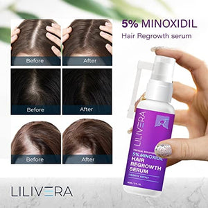 مصل نمو الشعر من مينوكسيديل  Minoxidil Hair Growth Serum for Women and Men With Biotin Hair Regrowth Treatment for Stronger Thicker Longer Hair Help to Stop Thinning and Loss Hair 60Ml 1 Month Supply