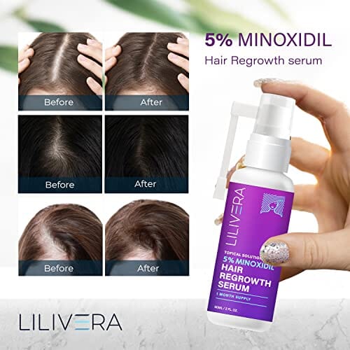 مصل نمو الشعر من مينوكسيديل  Minoxidil Hair Growth Serum for Women and Men With Biotin Hair Regrowth Treatment for Stronger Thicker Longer Hair Help to Stop Thinning and Loss Hair 60Ml 1 Month Supply